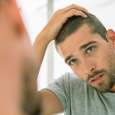 What Hair Loss Treatments are available?