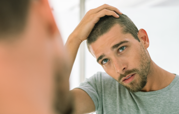 What Hair Loss Treatments are available?