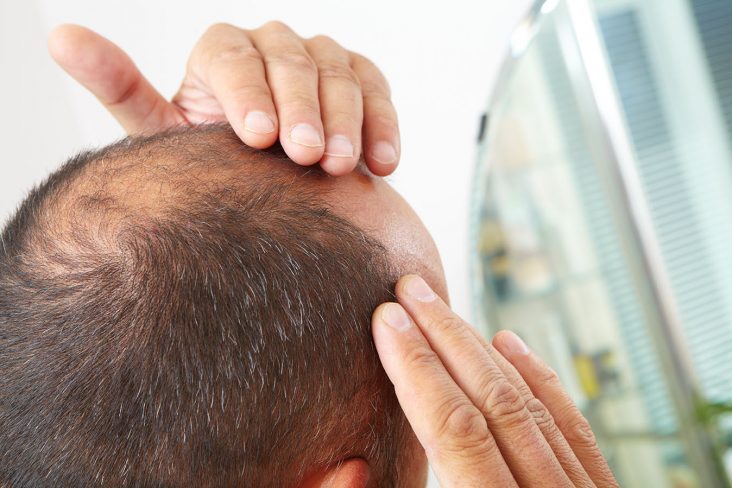 Male scalp examination