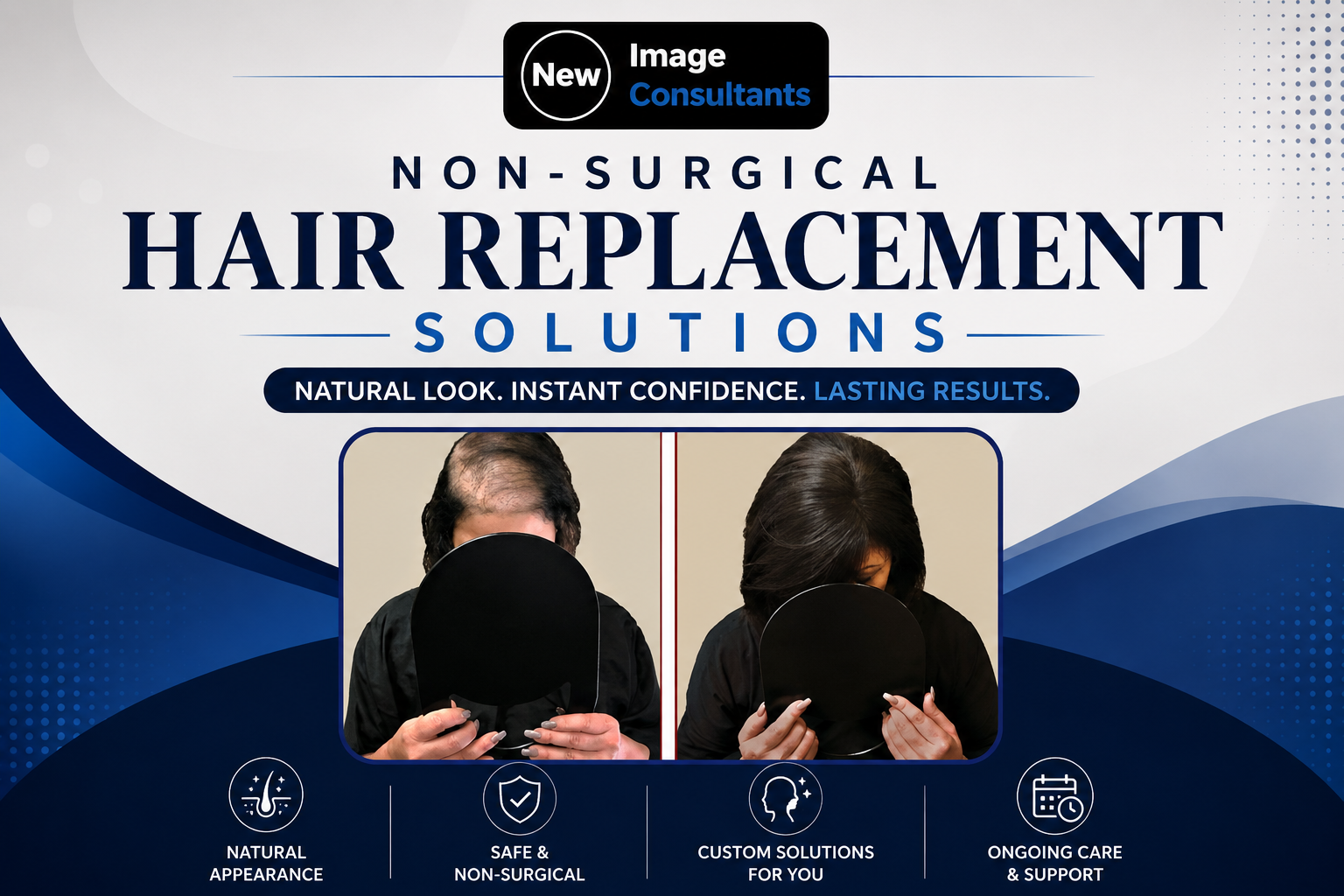 Non-Surgical Hair Replacement Solutions