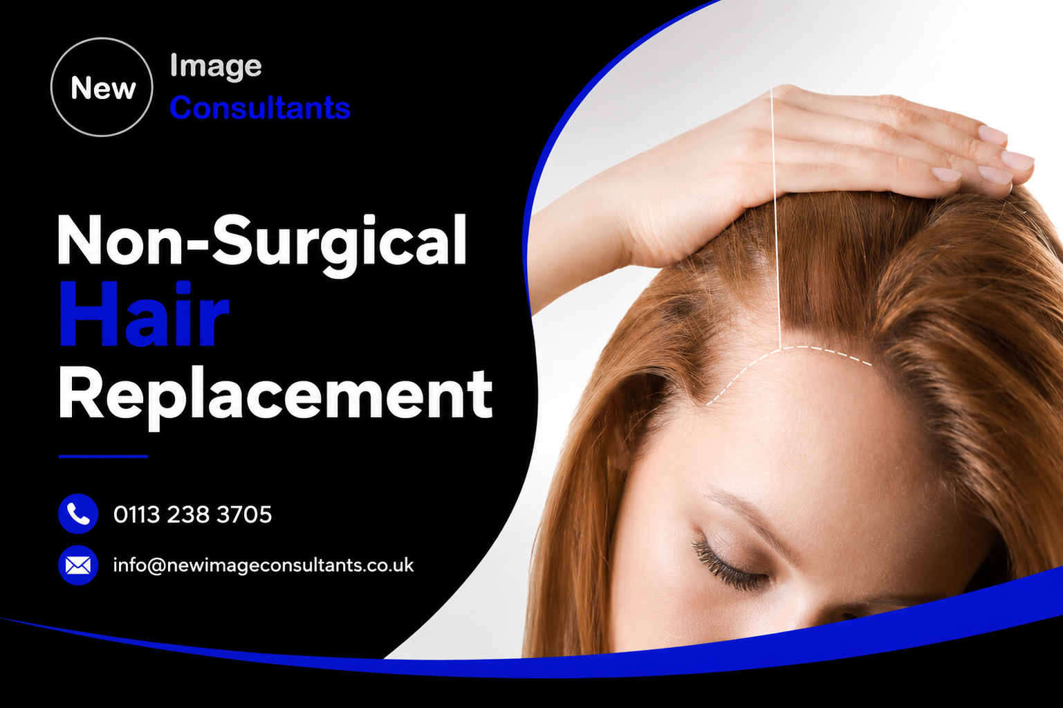 Non-Surgical Hair Replacement