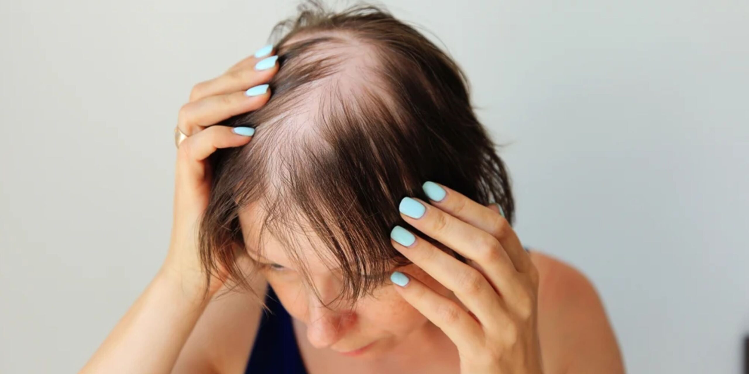women hair loss treatment