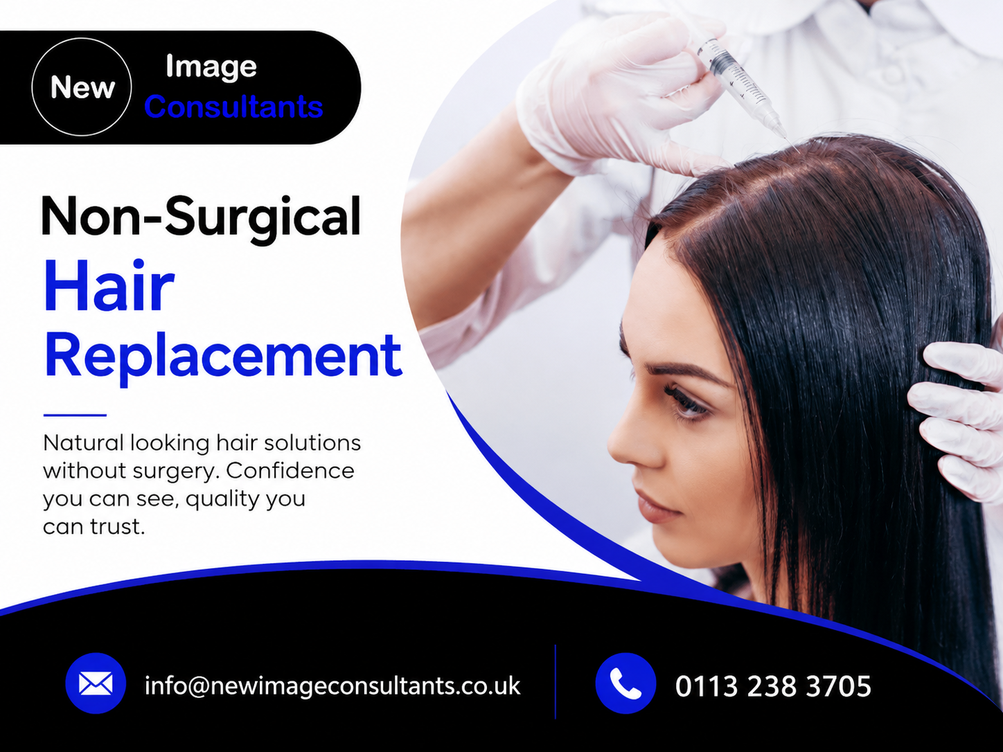 Non-Surgical Hair Replacement