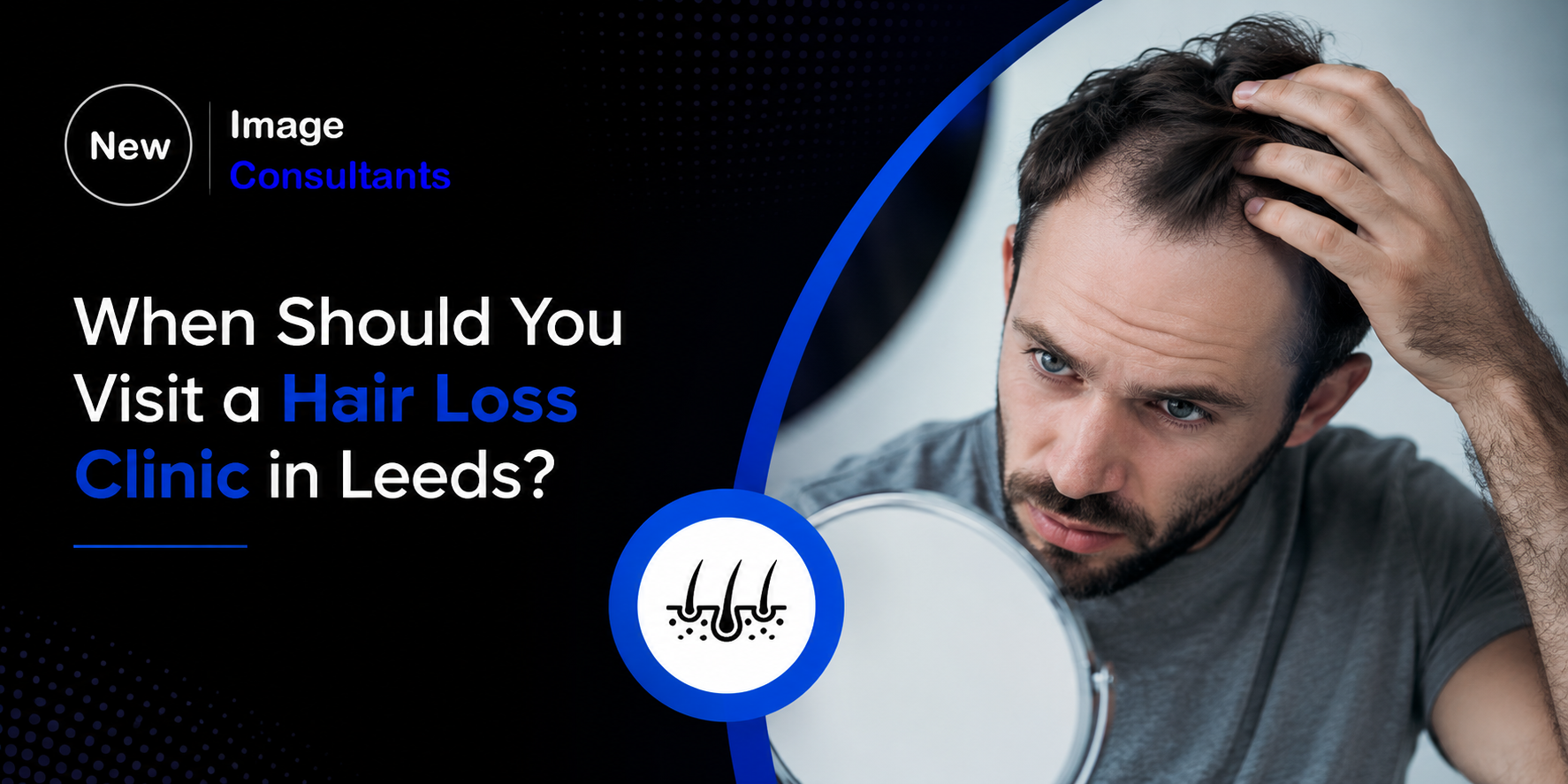 hair loss clinic Leeds