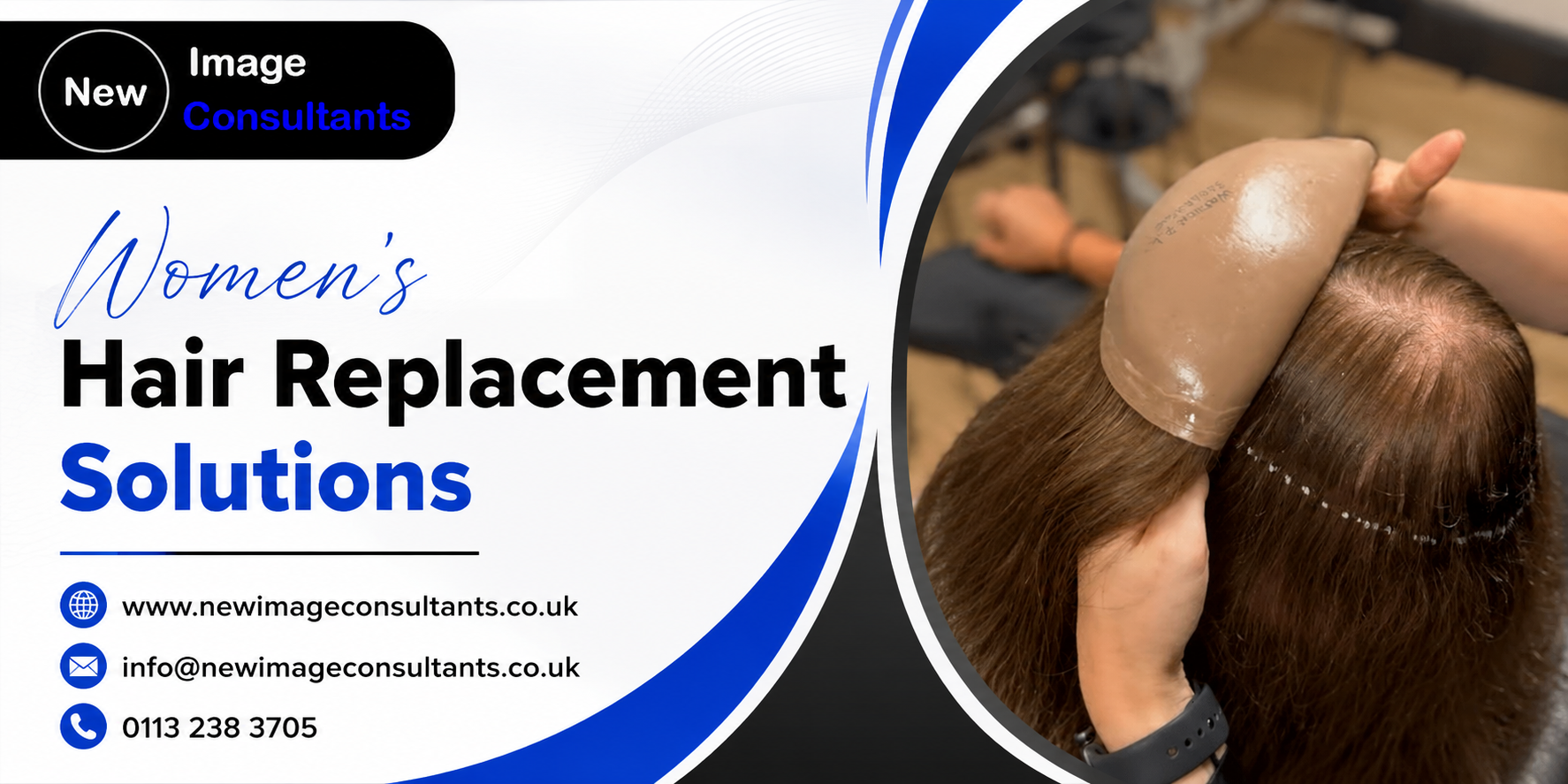 Women&rsquo;s Hair Replacement Solutions