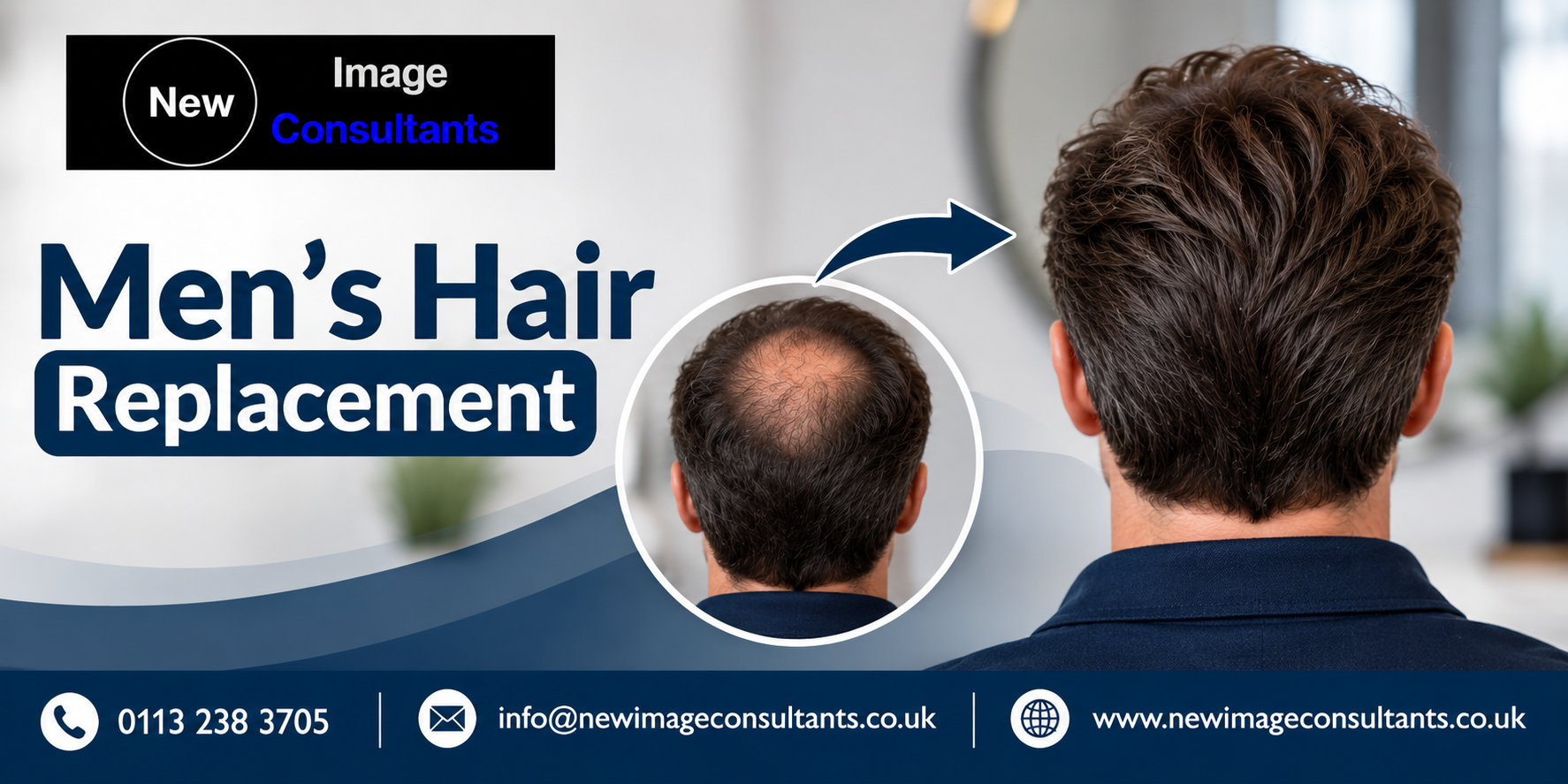 Men&rsquo;s Hair Replacement