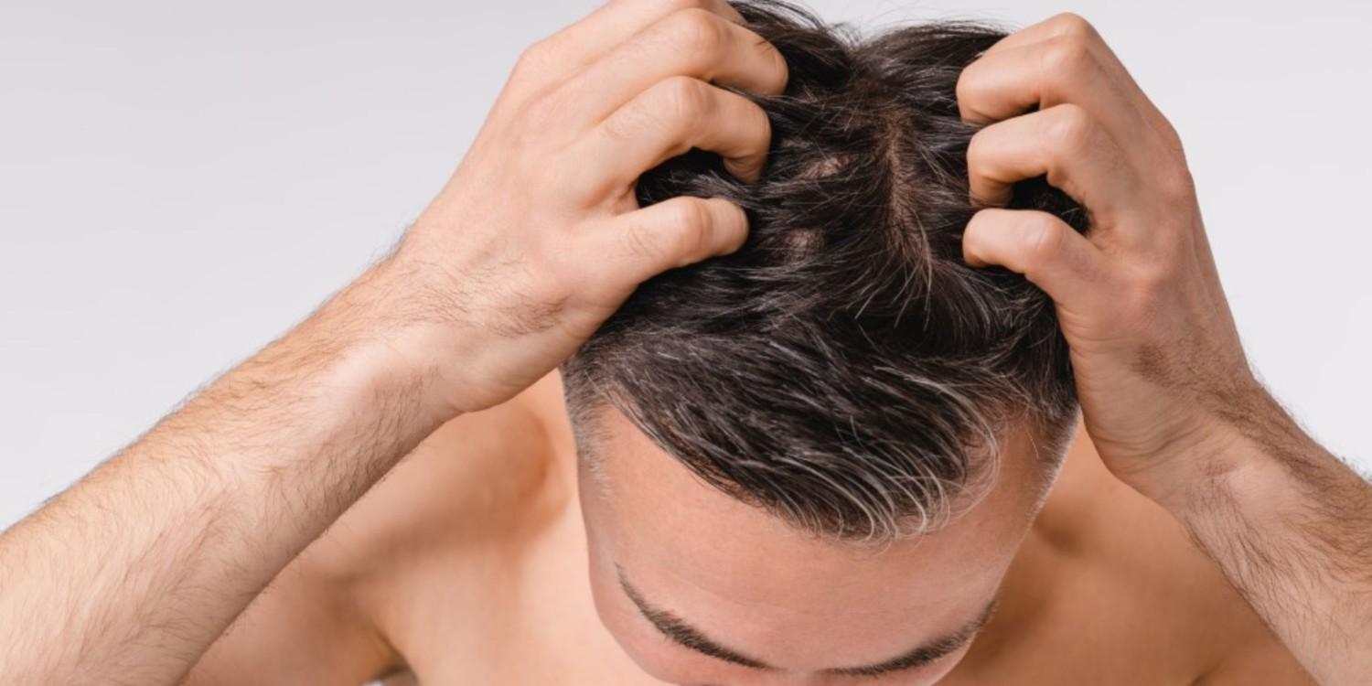 Affordable hair loss treatment